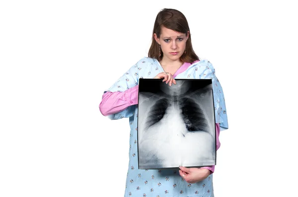 Beautiful Female Patient Holding Chest Ray — Stock Photo, Image