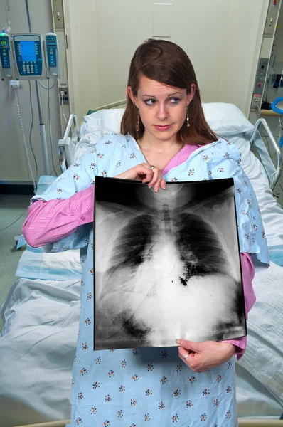 Красива Жінка Пацієнтка Тримає Рентген Грудей — стокове фото