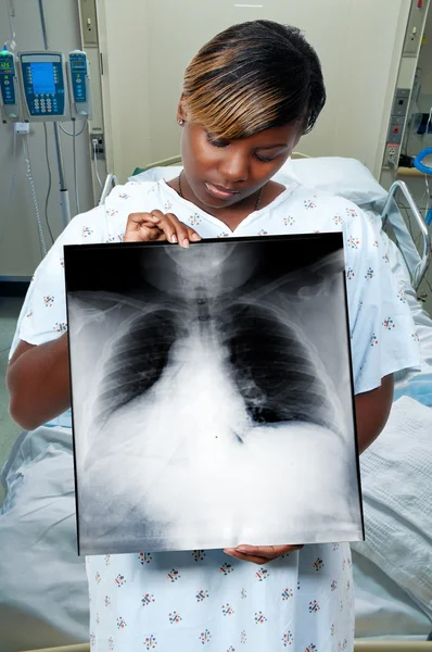 Uma Mulher Bonita Negra Afro Americana Paciente Segurando Raio — Fotografia de Stock