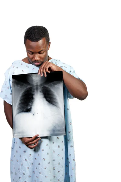 Paciente Afroamericano Negro Sosteniendo Una Radiografía —  Fotos de Stock