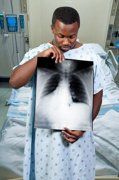 Negro Afro Americano Paciente Segurando Raio — Fotografia de Stock