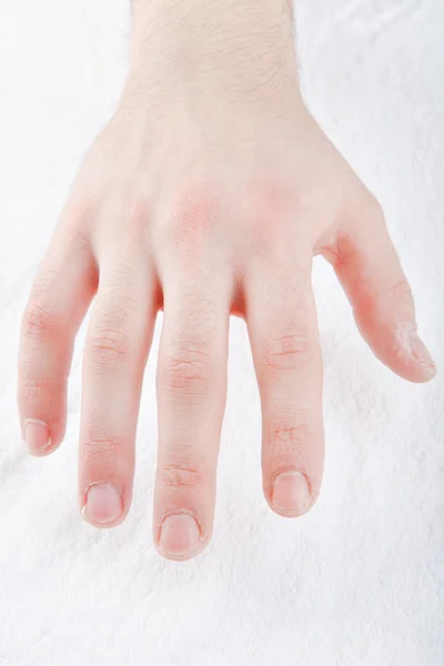 Men Toes Nail Polish White Background — Stock Photo, Image