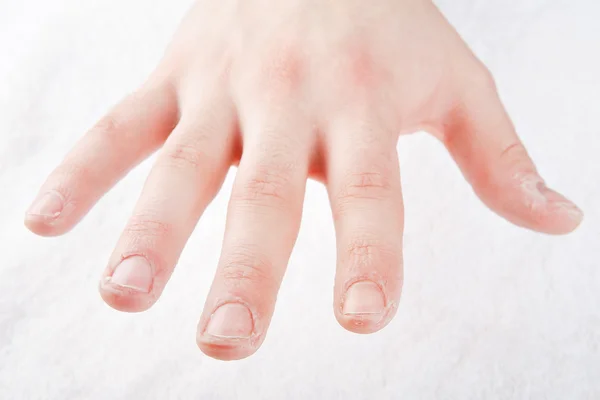 Men's fingers without a manicure — Stock Photo, Image