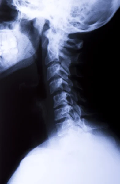 Gât lateral X-Ray — Fotografie, imagine de stoc