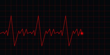 EKG Elektrokardiyogram