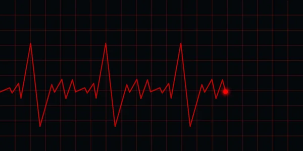 EKG EKG — Stock Fotó