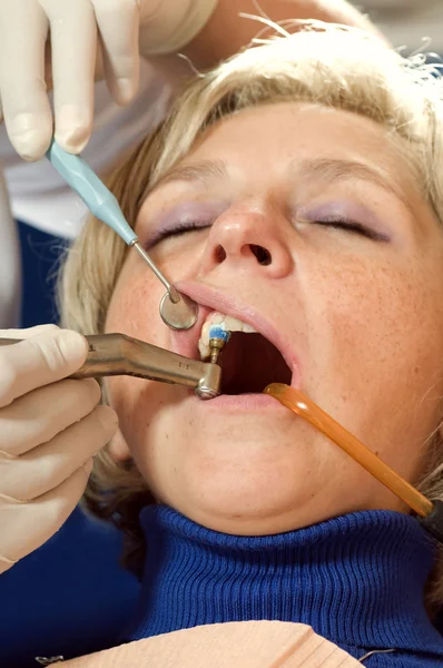 Diş beyazlatma — Stok fotoğraf