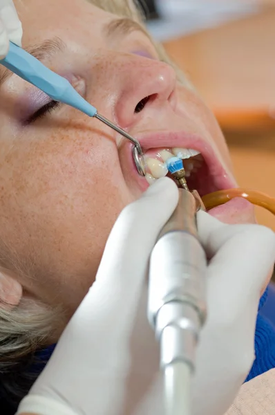 Teeth whitening — Stock Photo, Image