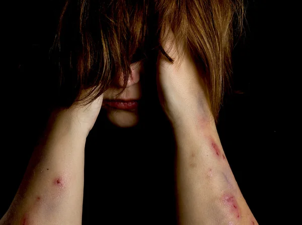 Violence Victim — Stock Photo, Image