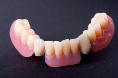 Diş balmumu modeli
