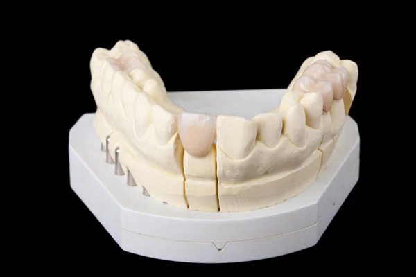 Wosk dentystyczny modelu — Zdjęcie stockowe