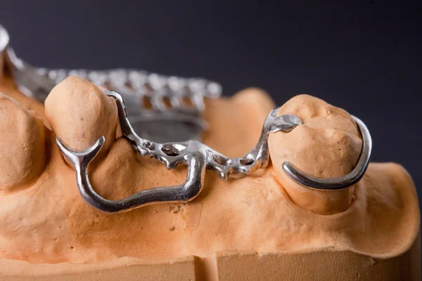 Dental wax model — Stock Photo, Image