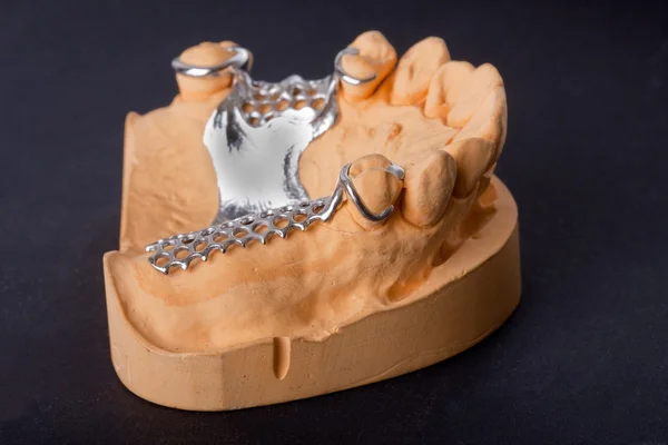 Modelo Cera Dentária Ower Fundo Preto — Fotografia de Stock