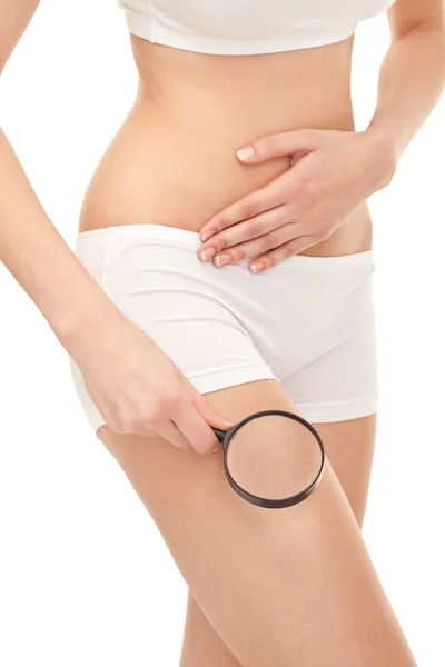Woman controls the cellulite on the thighs — Stock Photo, Image
