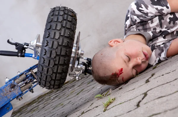 Rapaz após acidente — Fotografia de Stock