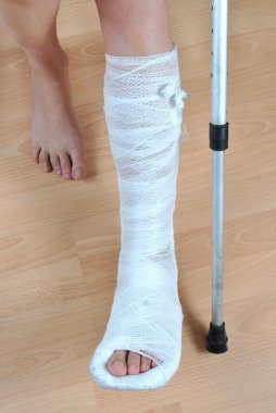 Broken leg clipart