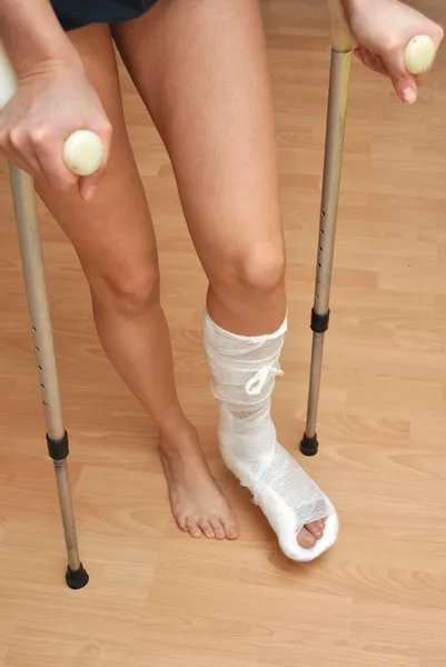 骨折した足 — ストック写真