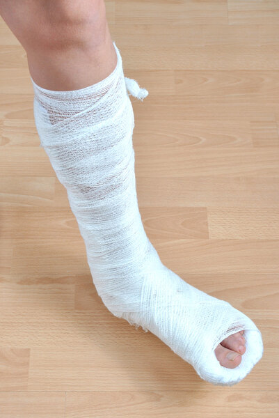 Сломанная нога