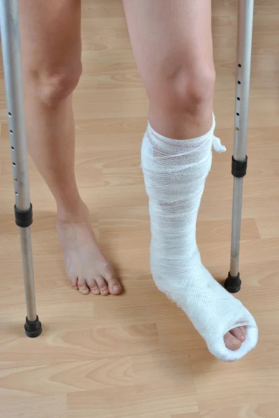 Σπασμένο πόδι — Φωτογραφία Αρχείου