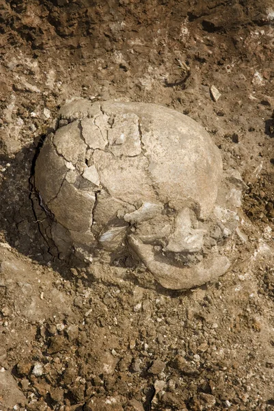 Grave burial skeleton human bones — Stock Photo, Image