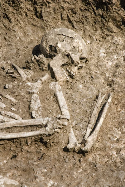 Súlyos temetkezési csontváz emberi csontok — Stock Fotó