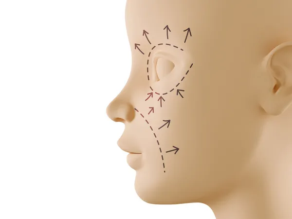Estetik cerrahi işareti tarafsız yüz profili — Stok fotoğraf