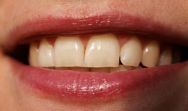 Kvinna tänder — Stockfoto