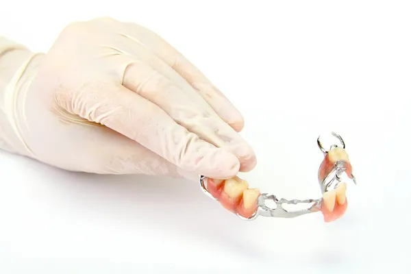Porcelain crowns, bridge (dentistry), dental plate — Stock Photo, Image