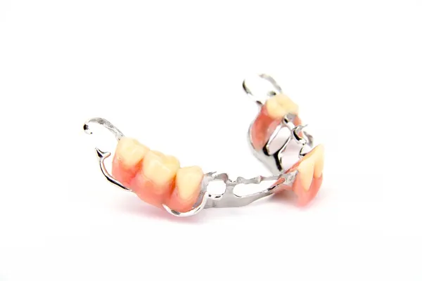 Falešné zuby (zubní protéza, koruny, most) ストックフォト