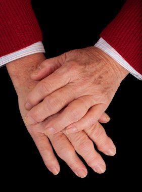 Arthritic hands of a senior woman on a black background. clipart