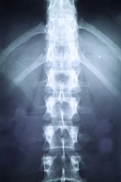 X ışını — Stok fotoğraf