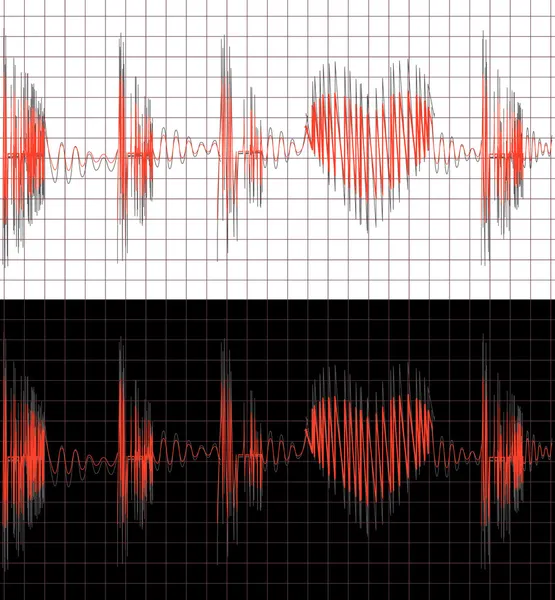 Equalizer Oder Elektrokardiogramm Mit Schwankungen Der Herzform — Stockvektor