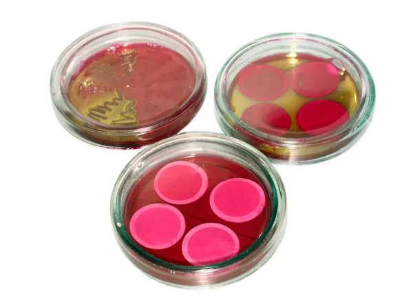 Skleněné šálky petri analýzy v laboratoři — Stock fotografie