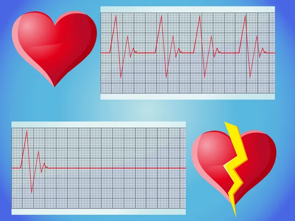 Καρδιακών Παλμών Εικονογράφηση Φορέας — Διανυσματικό Αρχείο