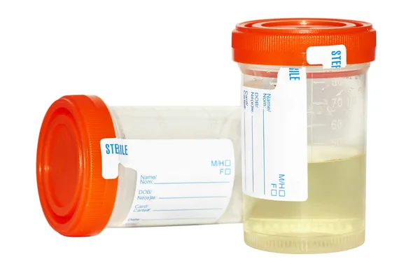 Urine sample and empty collection bottle — Stock Photo, Image