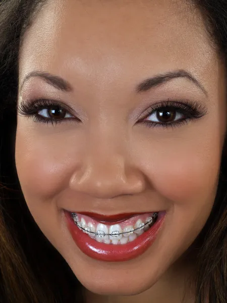 Snäva porträtt av leende svart kvinna med hängslen — Stockfoto