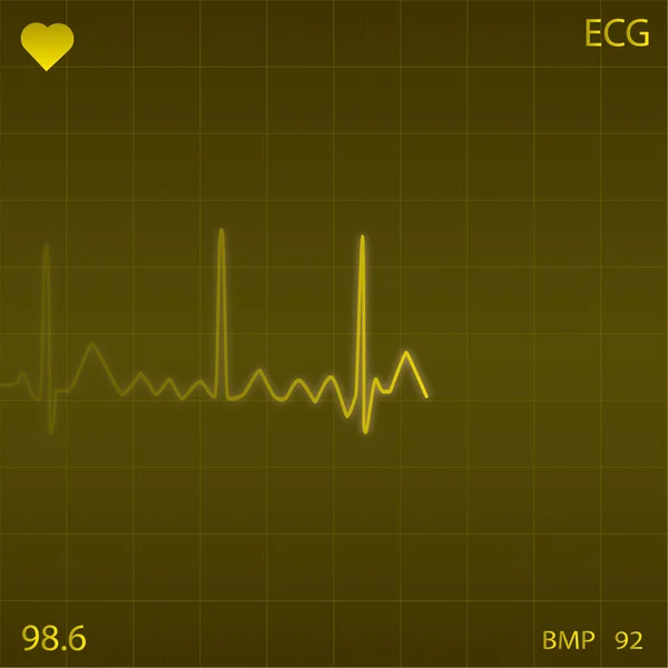 Srdeční monitor — Stockový vektor