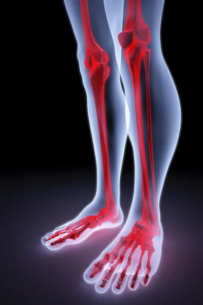 Male Feet Rays Bones Highlighted Red — Stock Photo, Image