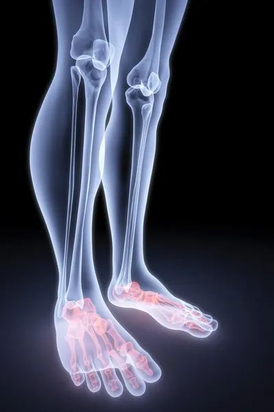 Erkek Ayakları Altında Röntgenleri Kemik Kırmızı Renkte Vurgulanır — Stok fotoğraf