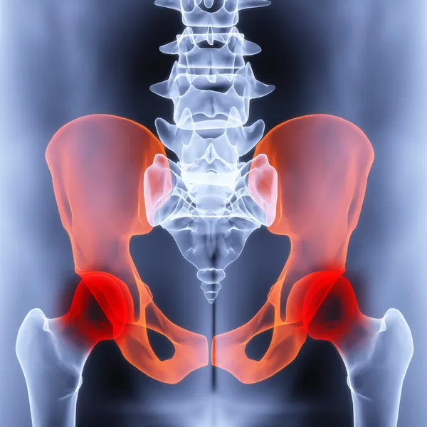 Pelvis Masculina Bajo Las Radiografías Las Articulaciones Resaltan Rojo — Foto de Stock