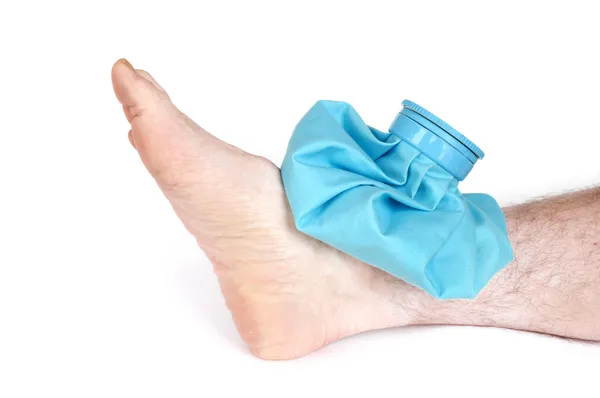 Icing a Sprained Ankle with Ice Pack — Stock Photo, Image