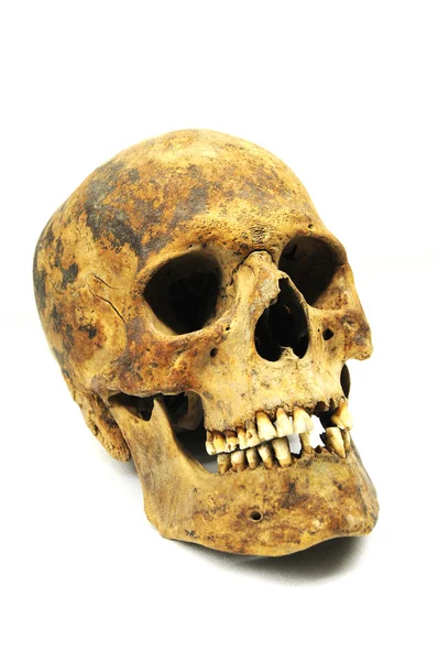 Skull of Caucasian — Stock Photo, Image