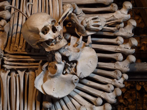 人間の頭蓋骨と骨 — ストック写真