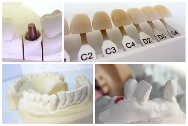 Zubní technik objekty — Stock fotografie
