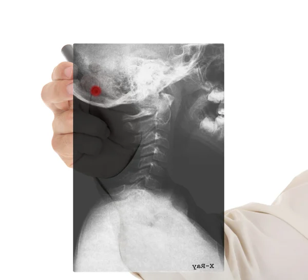 X-ray image of scull — Stock Photo, Image