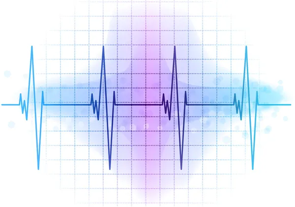 Diagrama EKG — Vector de stock