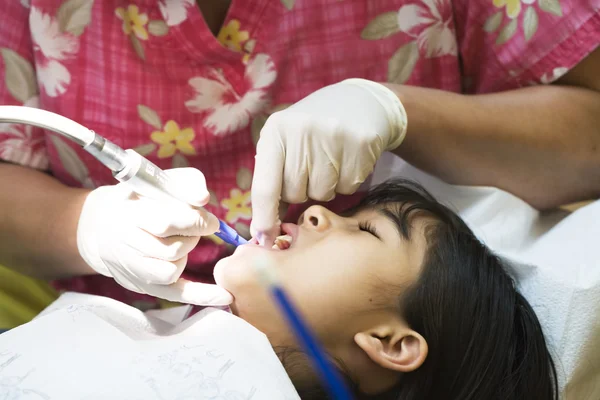 Gadis kecil yang memiliki gigi dibersihkan di kantor gigi — Stok Foto
