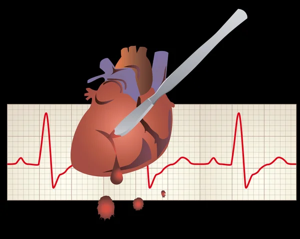 Hart Met Cardiogram Met Een Scalpel Snijden Een Zwarte Achtergrond — Stockvector