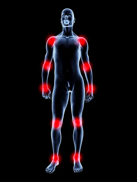 Ból stawów - anatomia — Zdjęcie stockowe