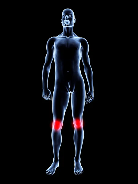 膝关节疼痛-解剖 — 图库照片